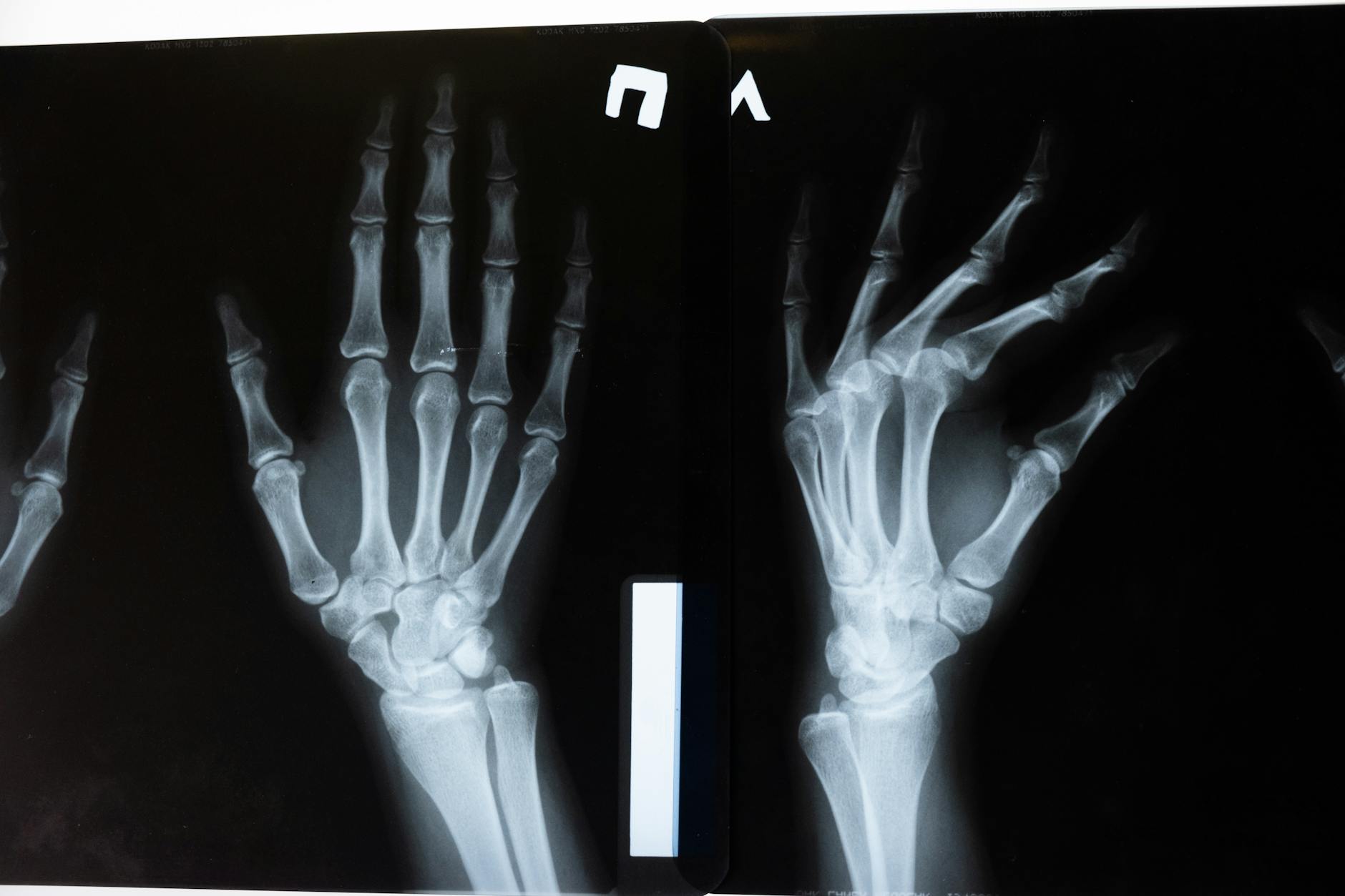 Orthopedic Equipment Suppliers